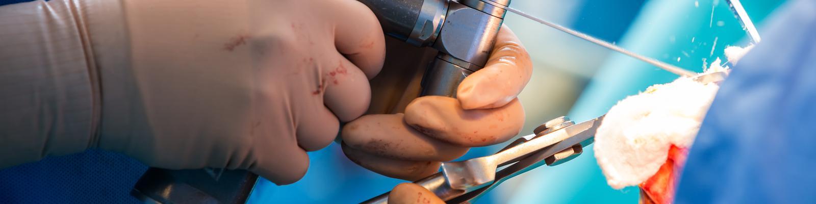 osteotomy