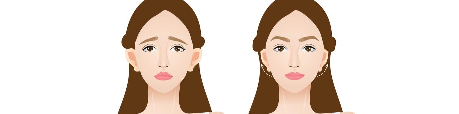 ear-surgery