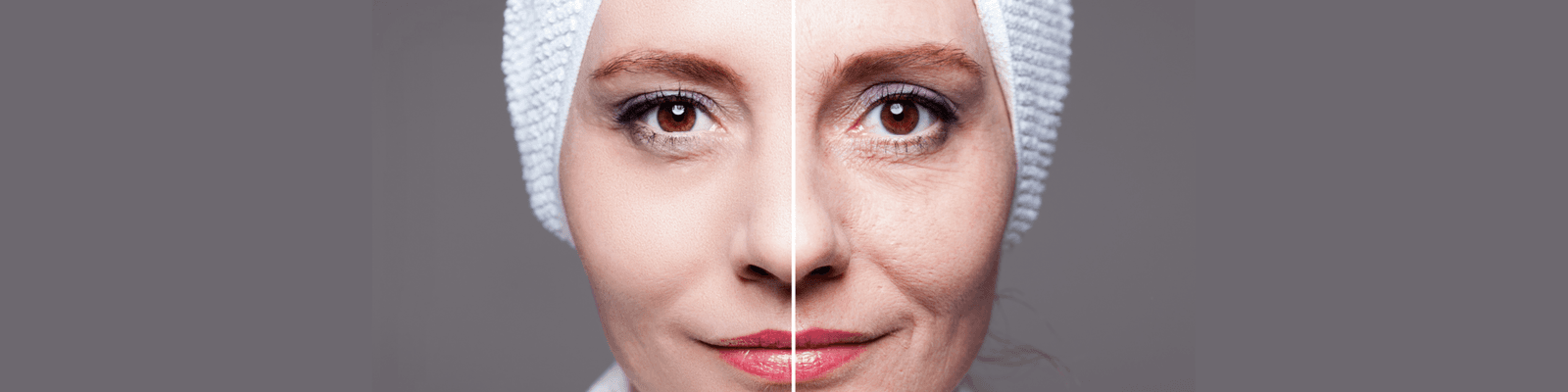 ultrasound-skin-therapy