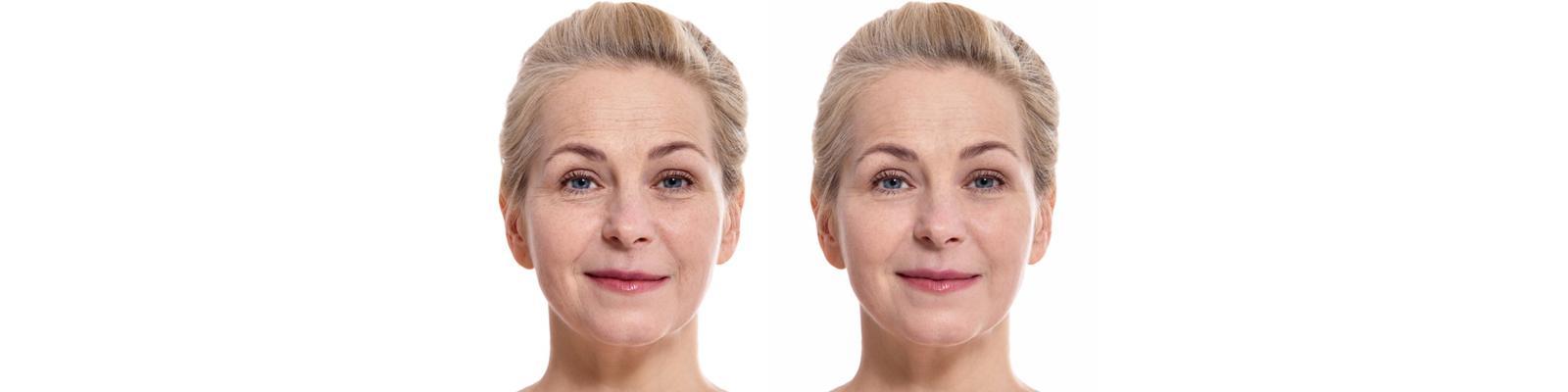 antiaging-treatments
