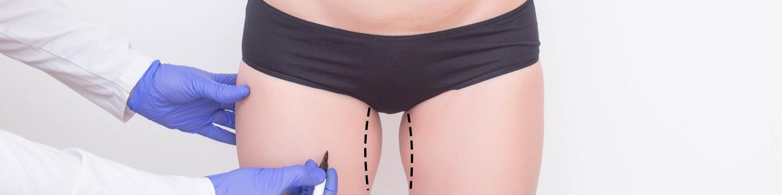 lipofilling