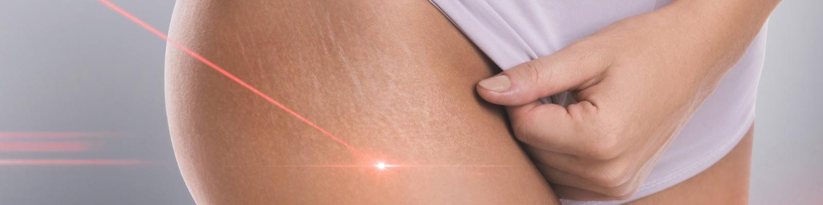 cellulaze