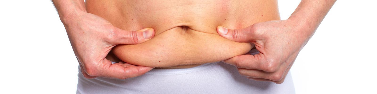 abdominoplasty
