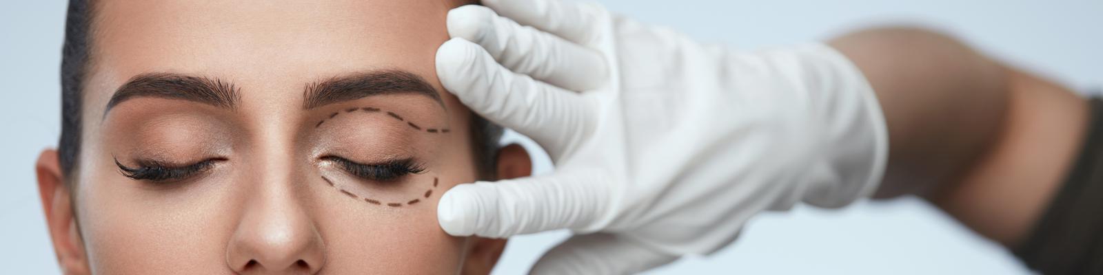 eyelid-lift
