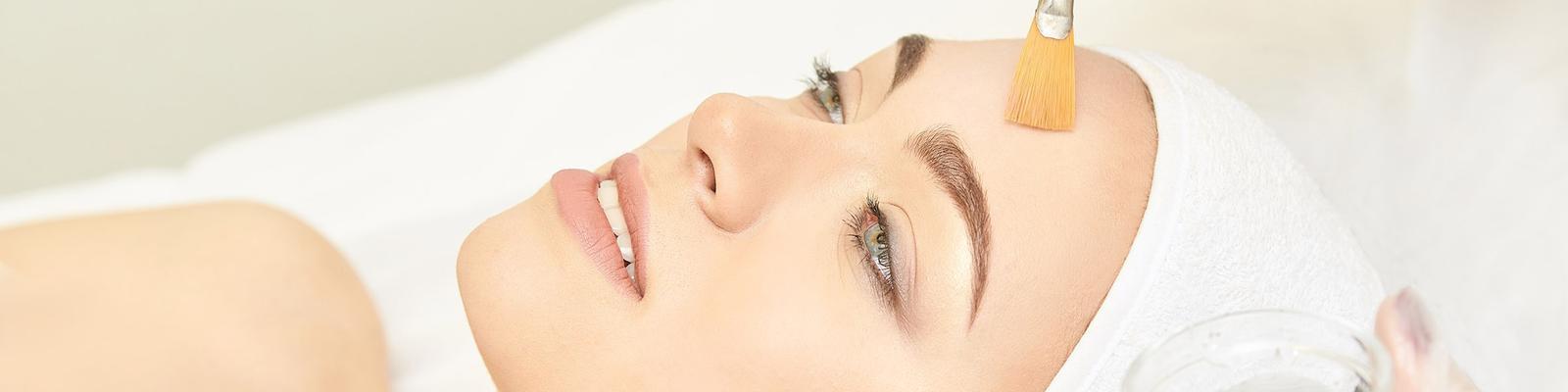 chemical-peel