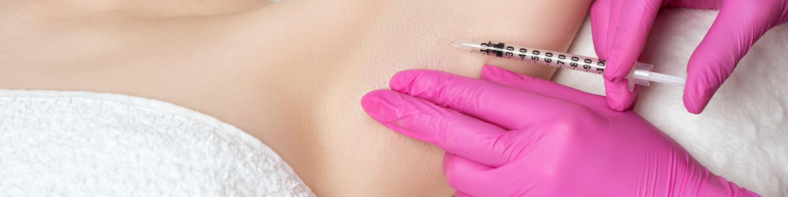 hyperhidrosis