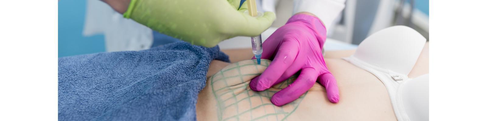 injection-lipolysis
