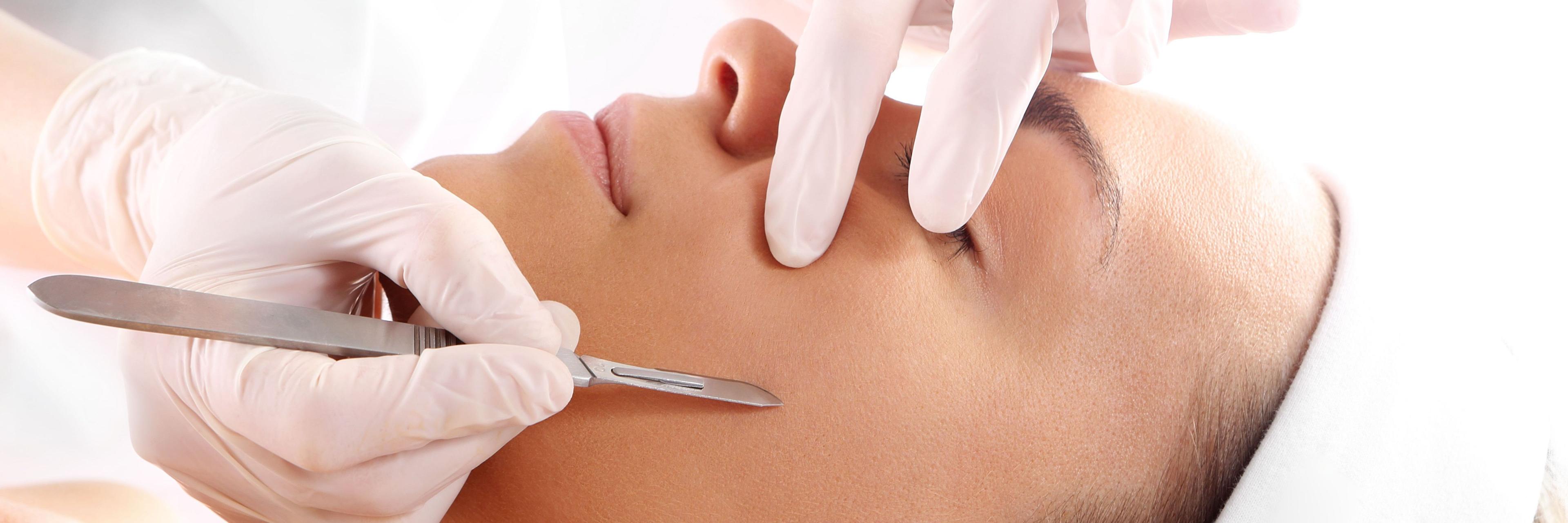 dermaplaning