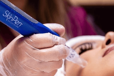 skinpen