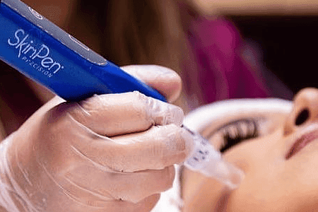 skinpen