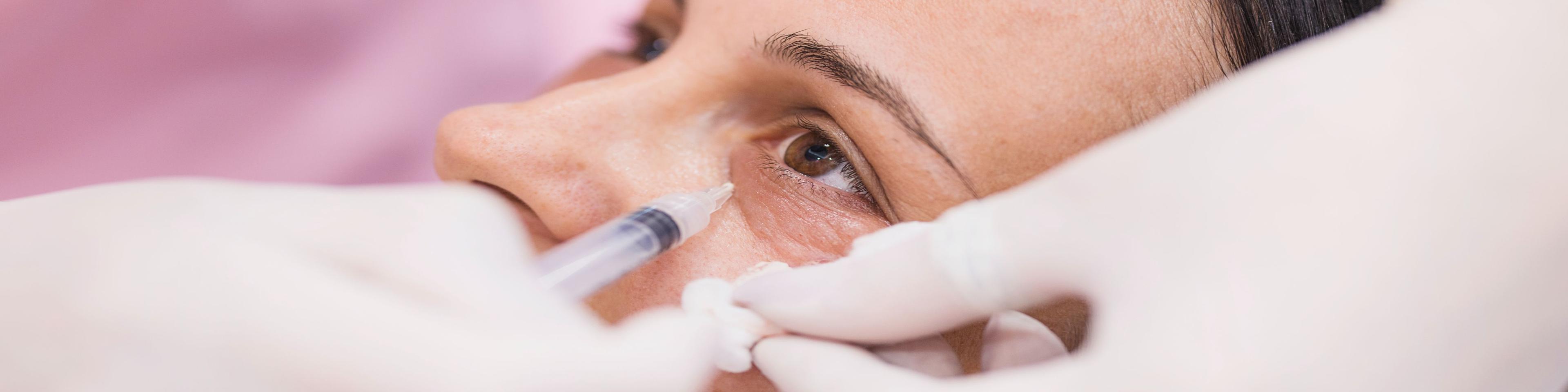 under-eye-fillers