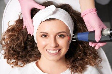 ablative-laser-resurfacing