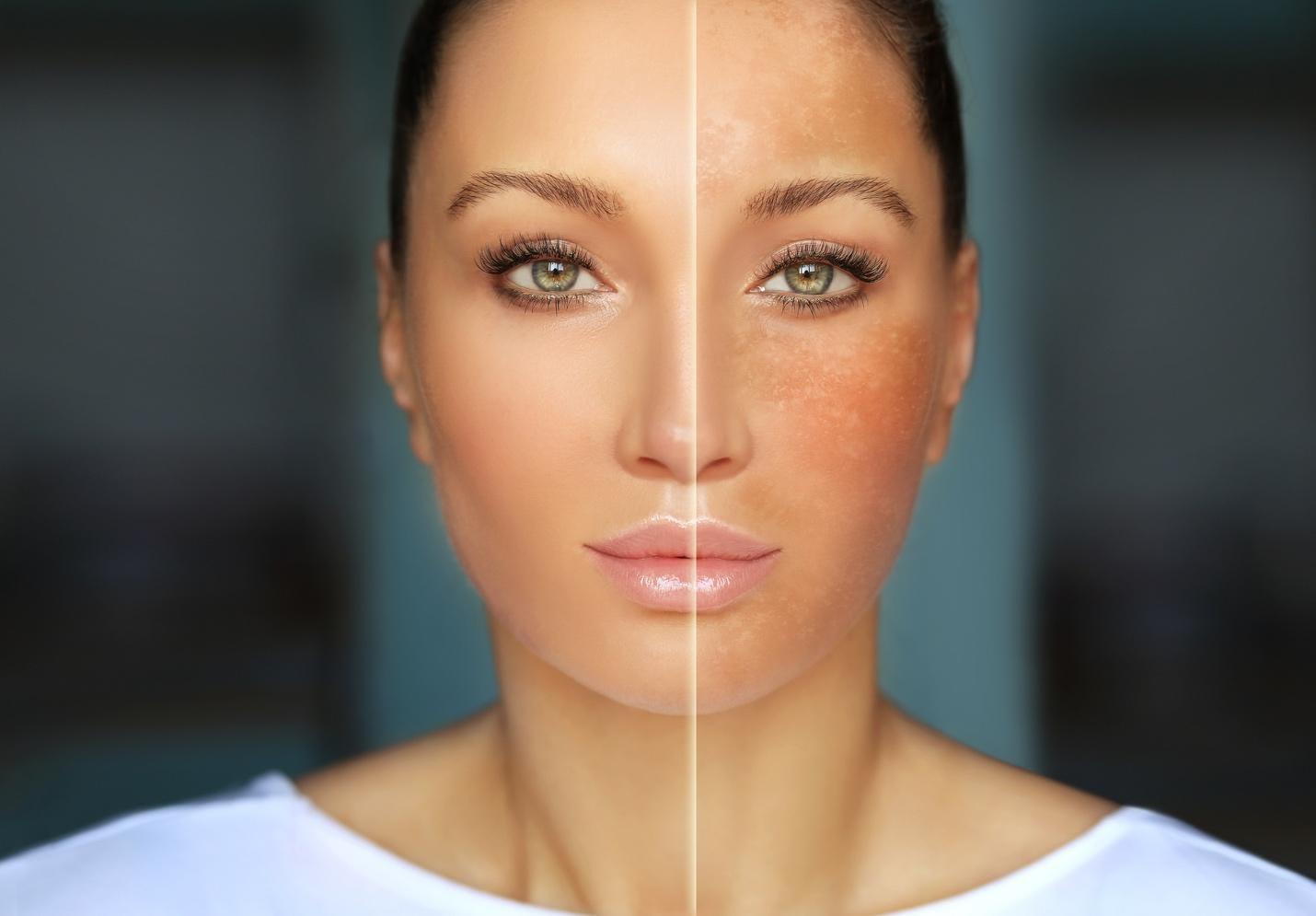 price-of-laser-procedures