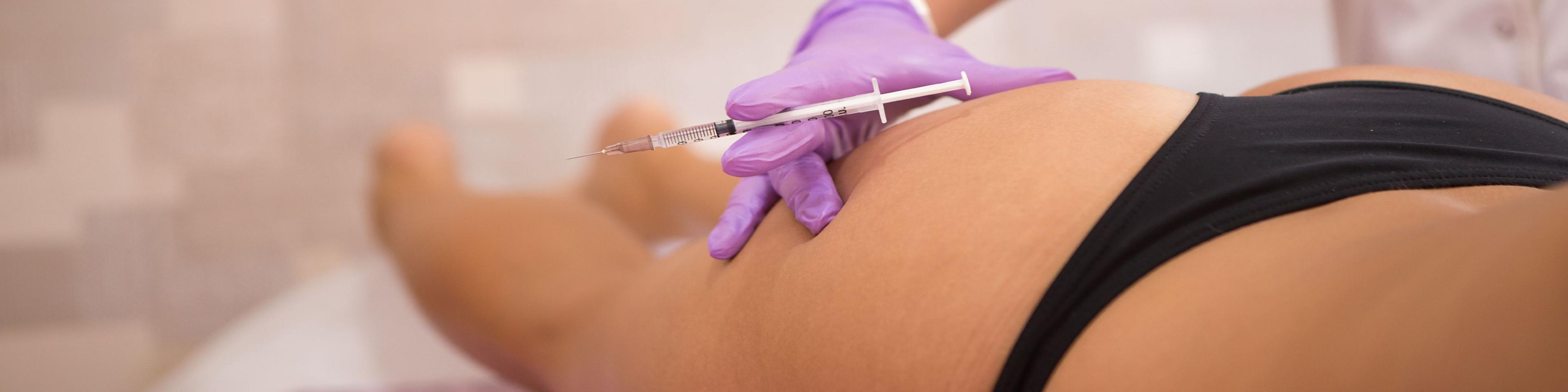 non‑surgical-brazilian-butt-lift