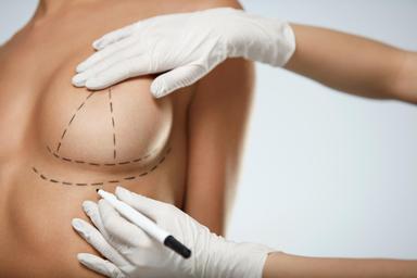 what-are-the-benefits-of-cosmetic-surgery