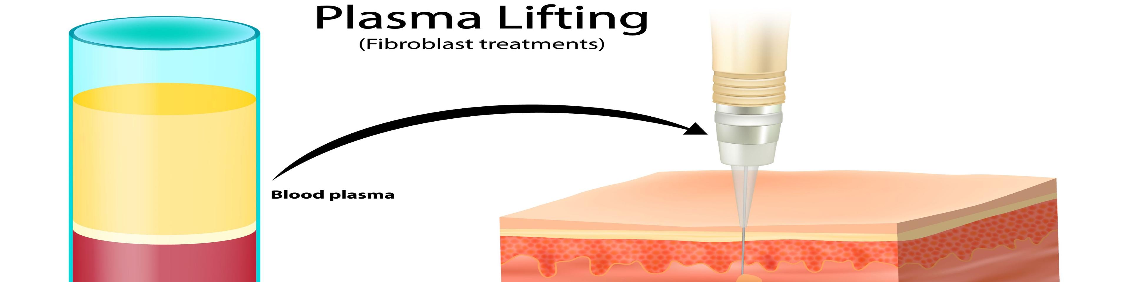 plasma-skin-tightening