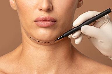 kybella