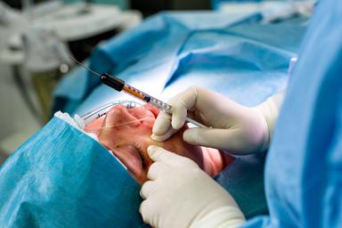 aftercare-and-recovery-from-a-facial-fat-transfer-procedure