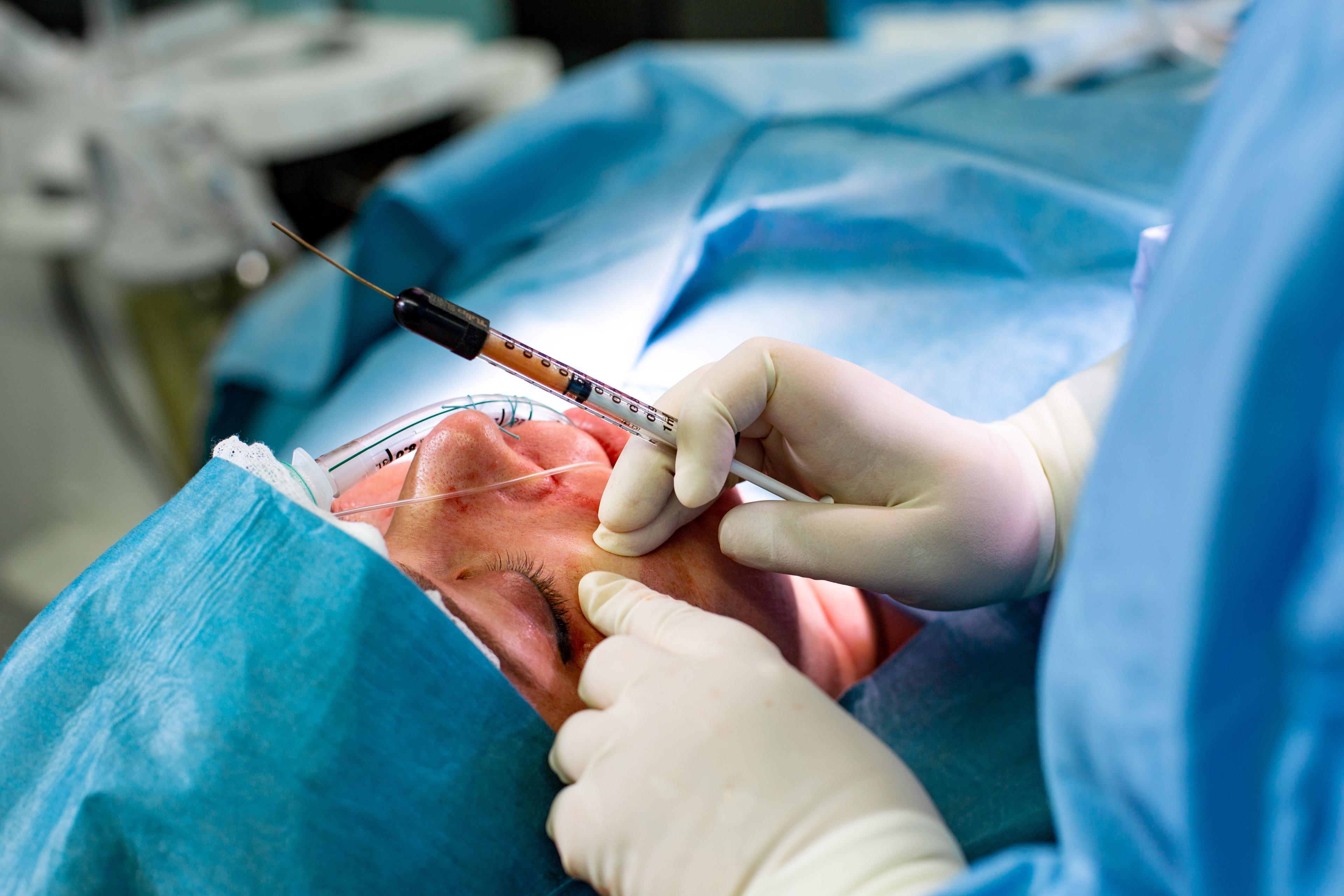 aftercare-and-recovery-from-a-facial-fat-transfer-procedure