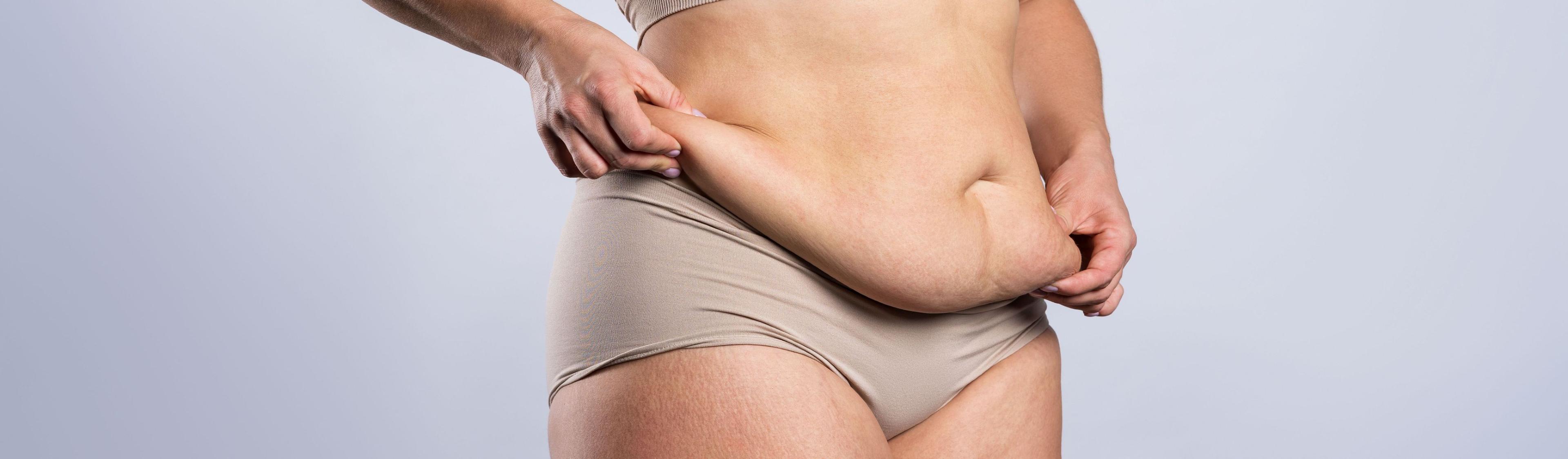 mini-tummy-tuck