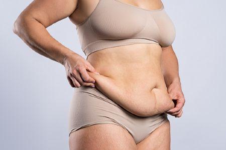 mini-tummy-tuck