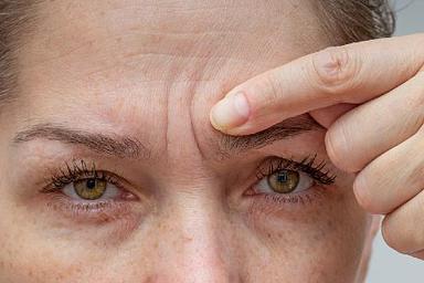 anti-wrinkle-injections