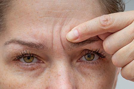 anti-wrinkle-injections